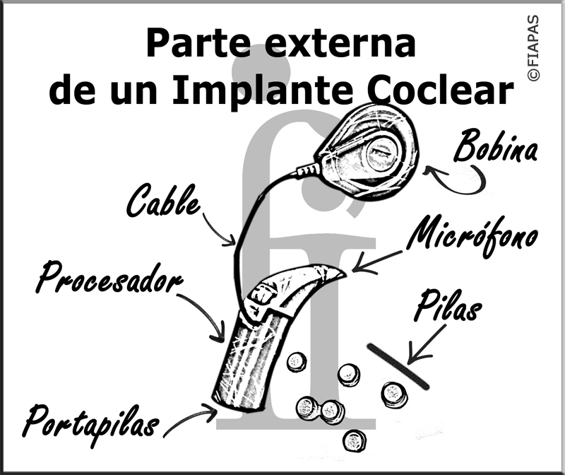 Ilustración de la parte externa de un implante coclear en el que señalan con flechas las diferentes partes del mismo