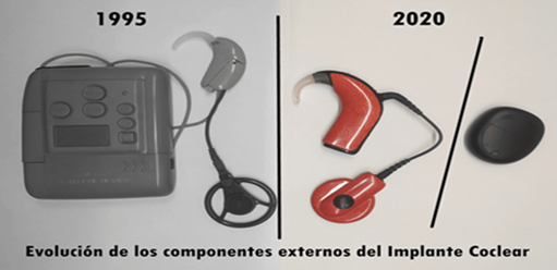 evolucion componentes externos